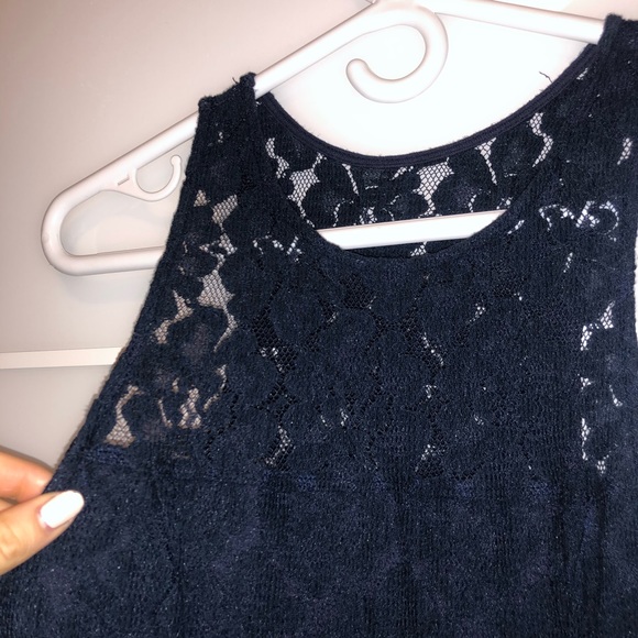 Hollister Lace Dress - Picture 2 of 3
